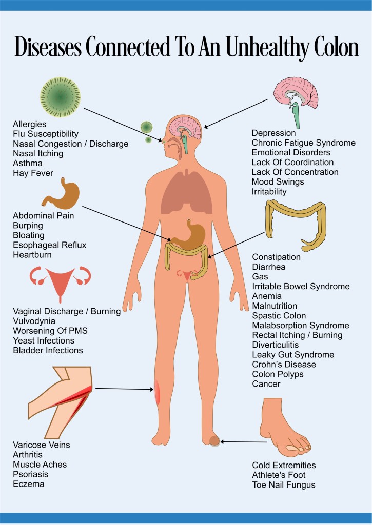 unhealthy-colon-diseases