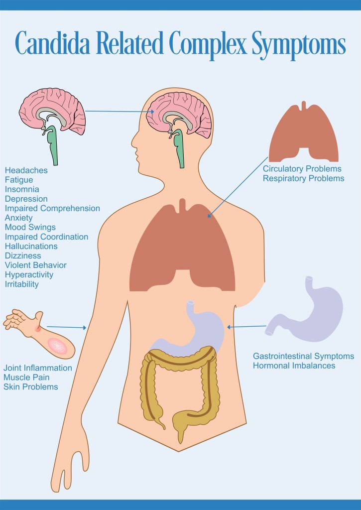 candida-related-complex-symptoms